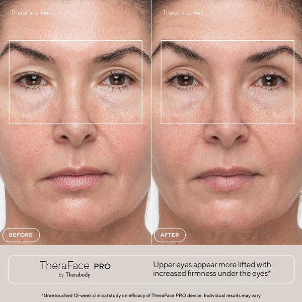 Therabody - TheraFace Pro