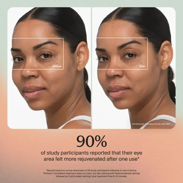 Therabody - TheraFace Depuffing Wand